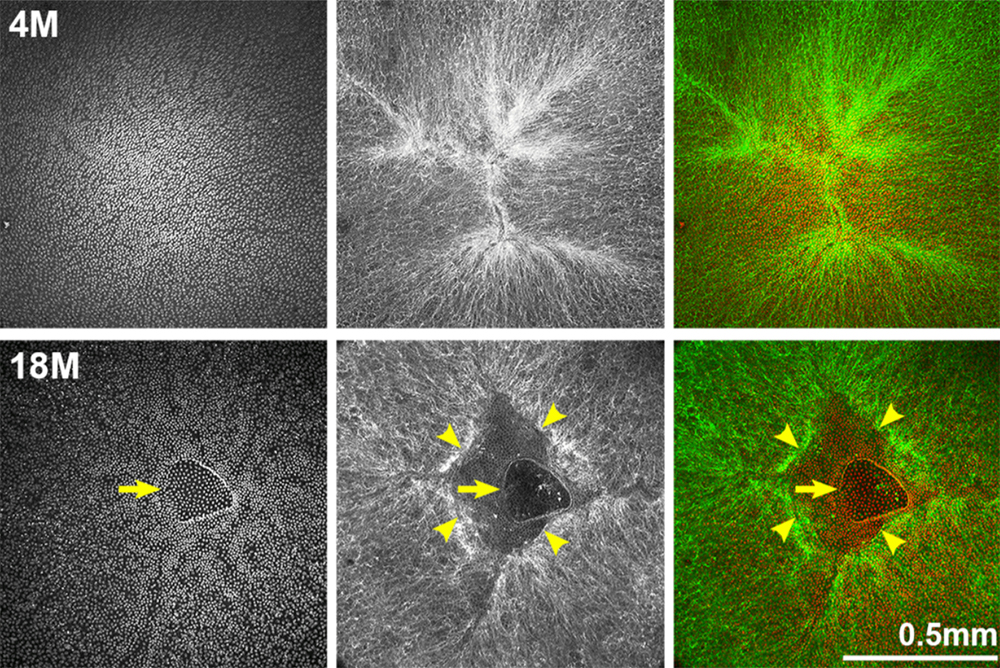 (Truncated) Figure 7. Whole lens staining for F-actin (phalloidin, green) and nuclei (DAPI, red) in 4-month-old and 18-month-old lenses.
