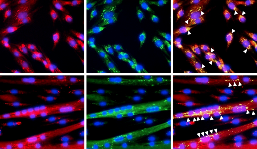 Figure 1. Expression of GRSF1 across myogenesis. (A) RT-qPCR analysis of GRSF1 mRNA levels in proliferating (0 h) and differentiating (24-120 h) human myoblasts; n=3. GRSF1 mRNA levels were normalized to the levels of GAPDH mRNA. (B) Western blot analysis of the levels of GRSF1 at the indicated times during differentiation; n=2. (C) Immunofluorescence detection of GRSF1 (green) and mitochondria (red) in proliferating myoblasts and differentiating myotubes. Arrowheads indicate GRSF1 signals; n=3. Scale bar, 50 μm.