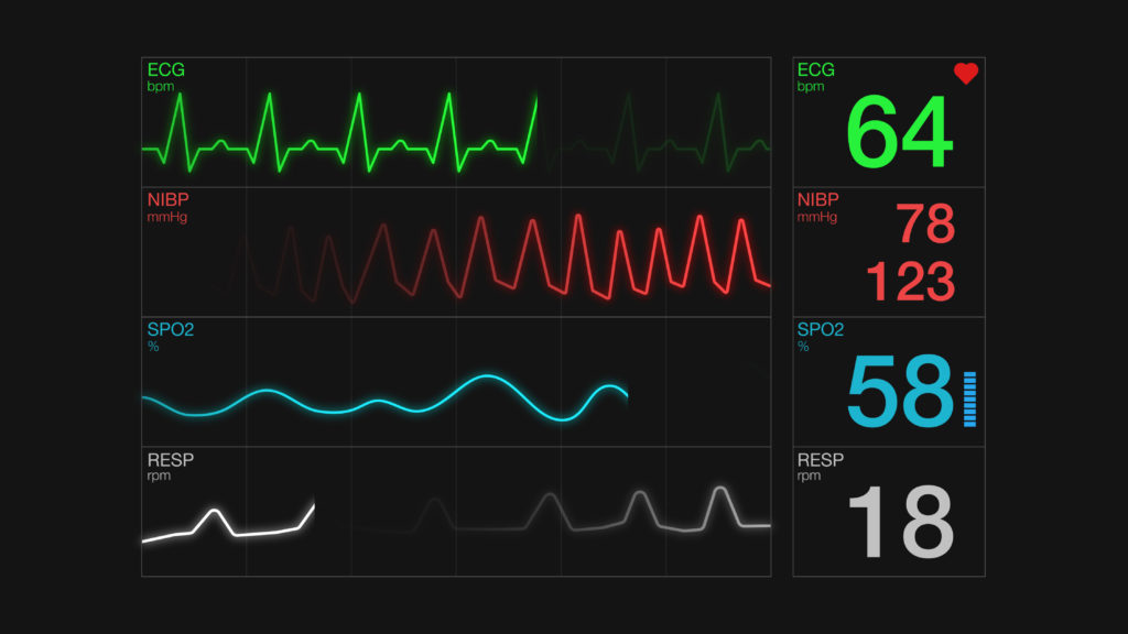 ecg ekg screen, heart rate
