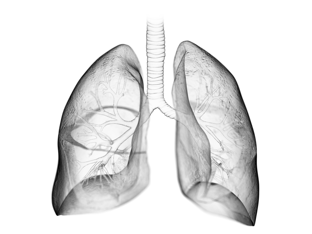 Investigating Susceptibility to Radiation-Induced Pulmonary Fibrosis